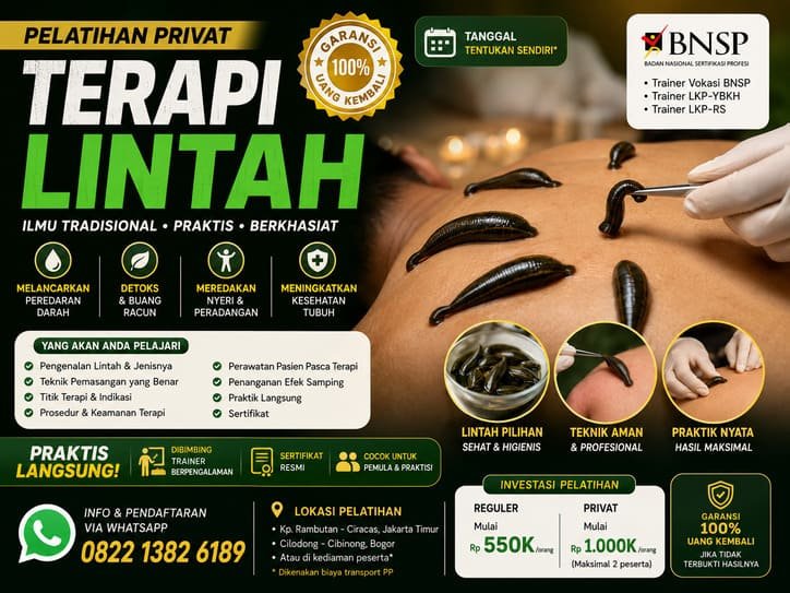 Terapi Lintah